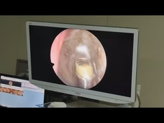 Appareil de chirurgie Générateur de plasma radiofréquence à haute fréquence